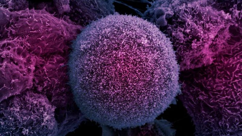 Pesquisadores criam IA capaz de diferenciar células cancerígenas das saudáveis